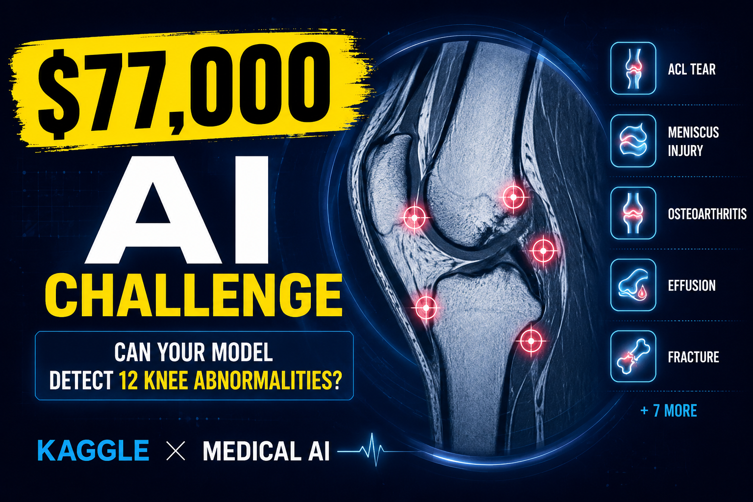 RSNA Knee Abnormality Detection $77,000 Kaggle AI Challenge